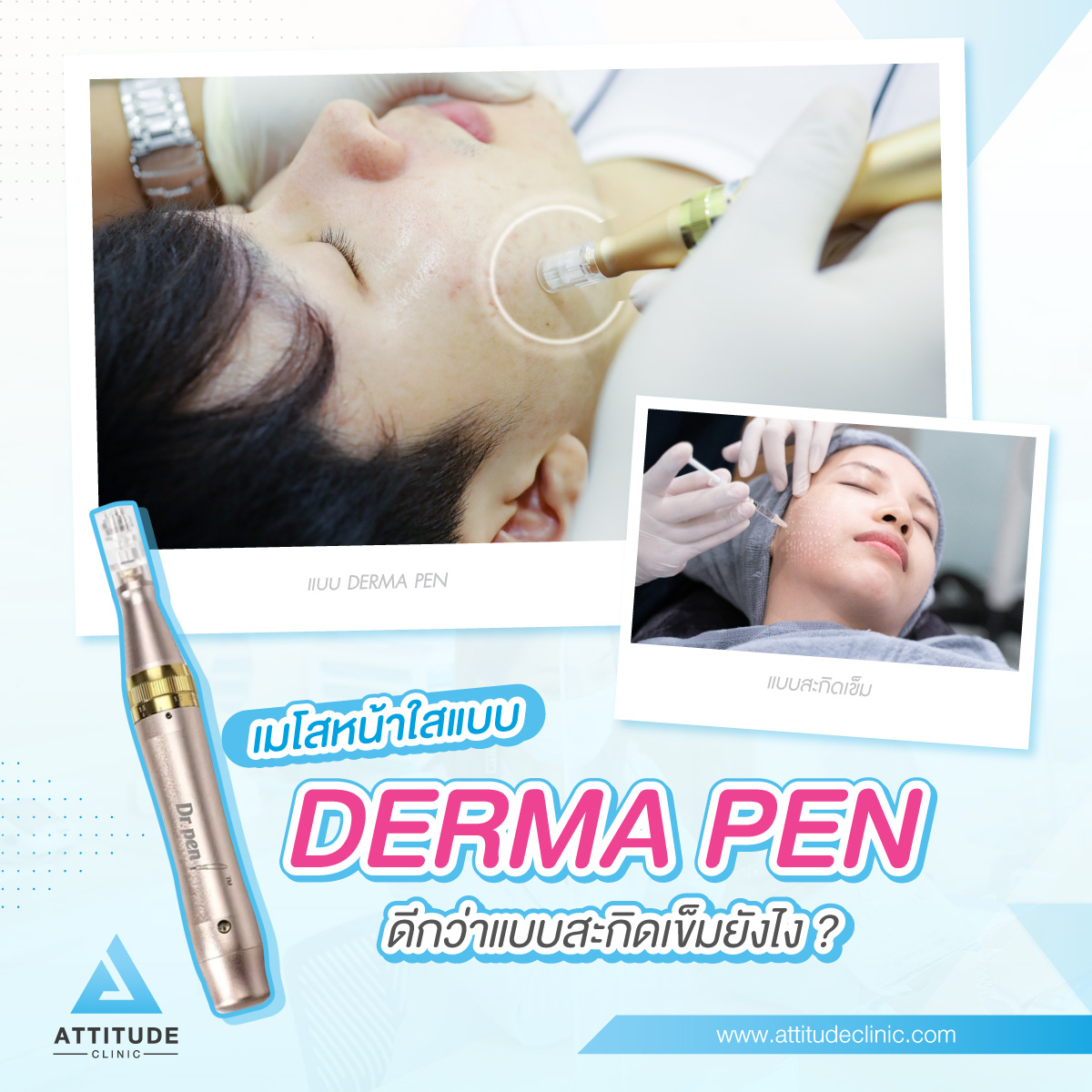?เมโสหน้าใส แบบ Derma Pen ดีกว่าแบบสะกิดเข็มยังไง? ATTITUDE CLINIC