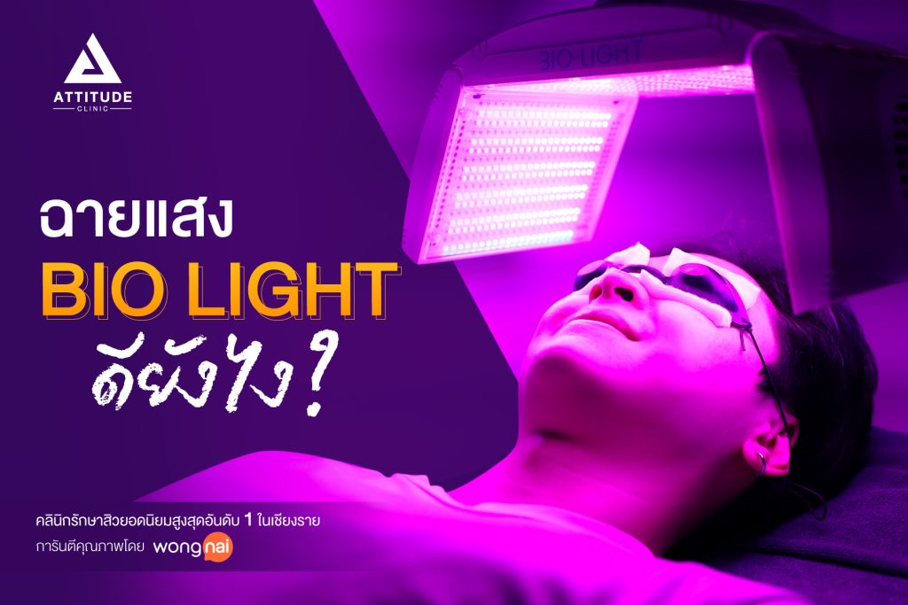 ฉายแสงรักษาสิว ด้วยเครื่อง Bio Light ดียังไง ? 