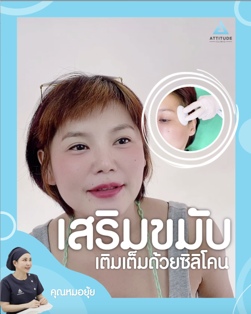 เสริมขมับด้วยซิลิโคน