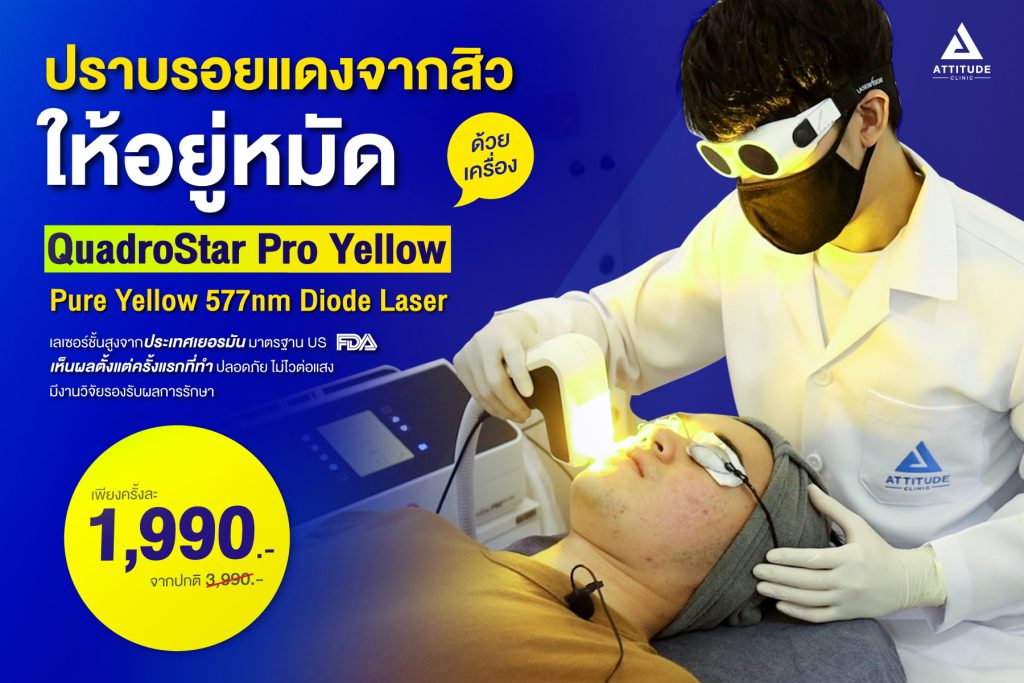 เลเซอร์รักษารอยแดงจากสิว สิวอักเสบ Quadrostar Pro Yellow laser นวัตกรรมเลเซอร์ชั้นสูงจากประเทศเยอรมัน มาตรฐาน US FDA ?? เครื่องแรกในเชียงราย มีงานวิจัยรับรองผลการรักษา จาก รพ.ศิริราช เห็นผลดี ไม่เจ็บ ไม่ต้องทายาชา