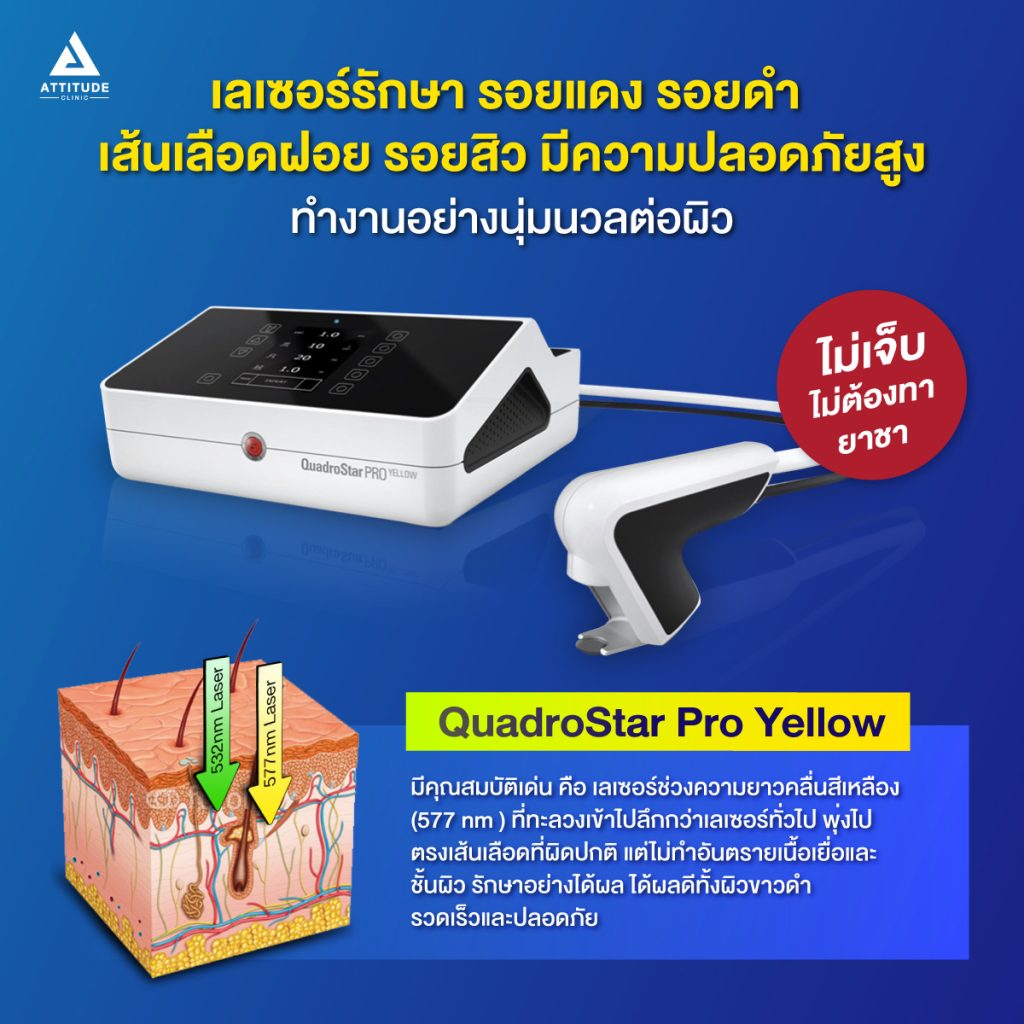 Quadrostar Pro Yellow laser