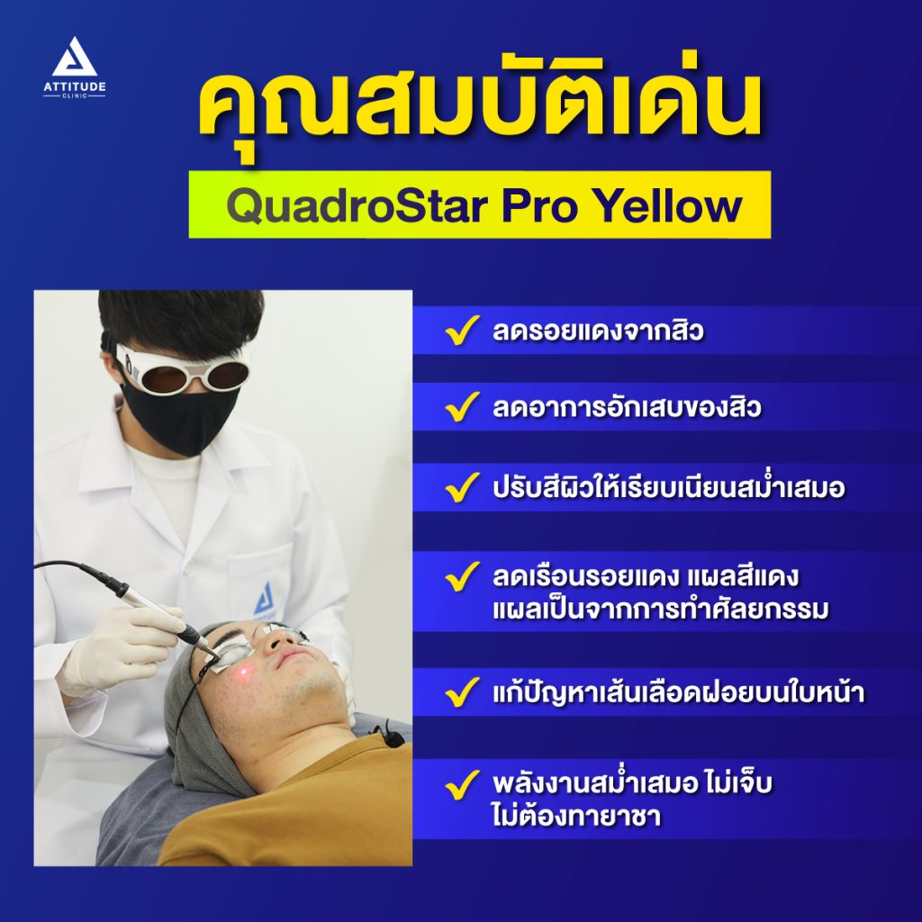 คุณสมบัติ Quadrostar Pro Yellow laser
