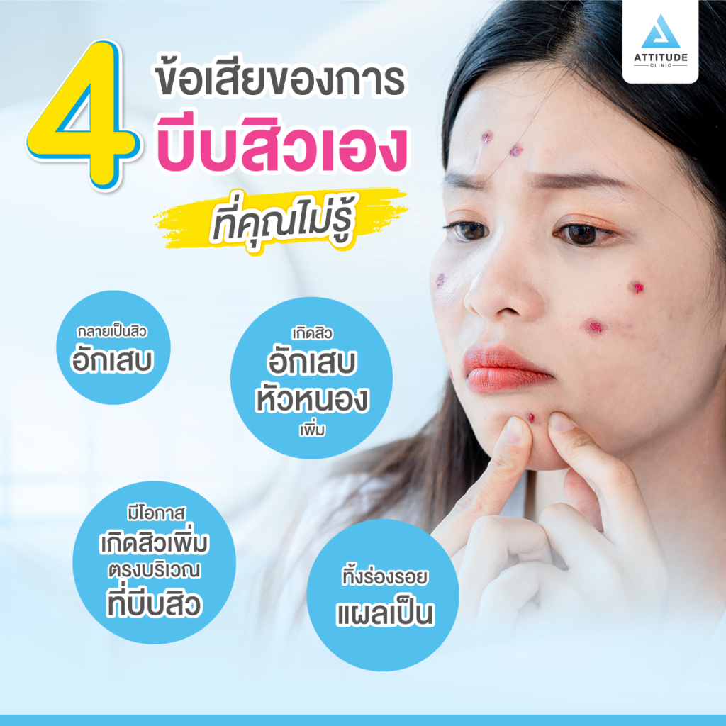 4 ข้อเสียของการบีบสิวเอง ที่คุณไม่รู้ !! Attitude Clinic มีคำตอบ ?