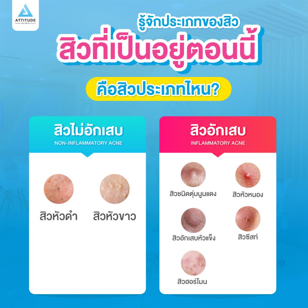 รู้จักประเภทสิว สิวที่เป็นอยู่ตอนนี้คือสิวประเภทไหน? สิวอักเสบ หรือสิบอุดตัน