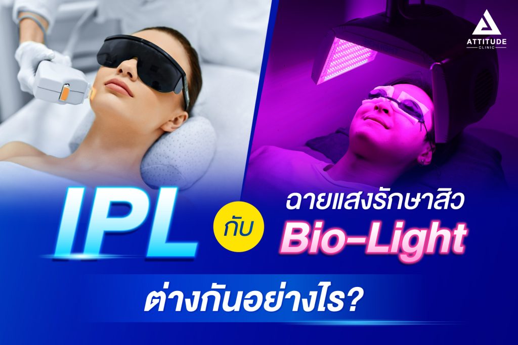 ฉายแสงรักษาสิว Bio-Light กับ IPL ที่ Attitude Clinic ต่างกันอย่างไร??