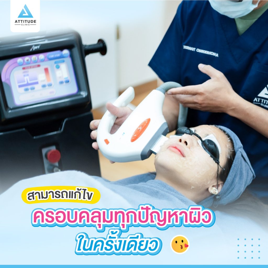 สุดยอดเลเซอร์ IPL หน้าใส  ครอบคลุมทุกปัญหา ผิวเนียนกริบ ที่ Attitude Clinic