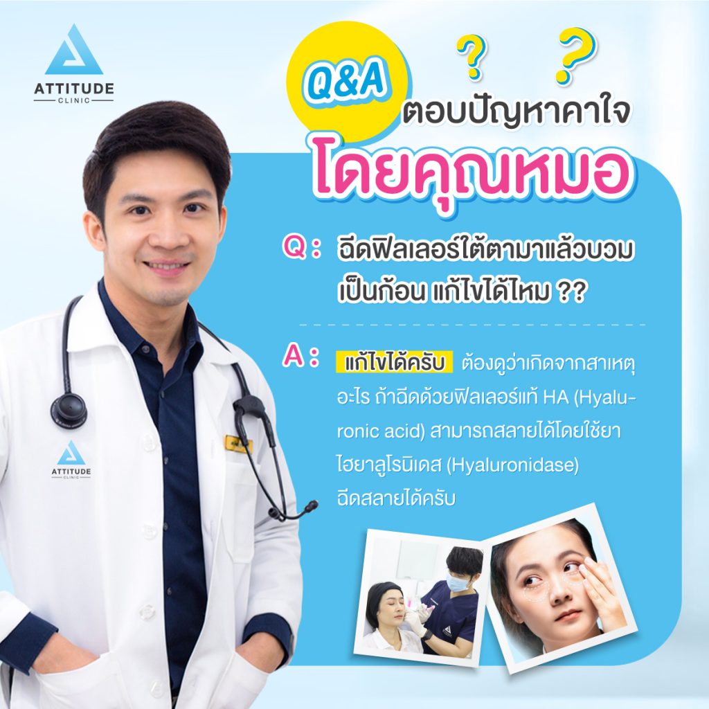 Q&A ตอบปัญหาคาใจโดยคุณหมอ : ฉีดฟิลเลอร์ใต้ตามาแล้วบวม เป็นก้อน แก้ไขได้ไหม ??