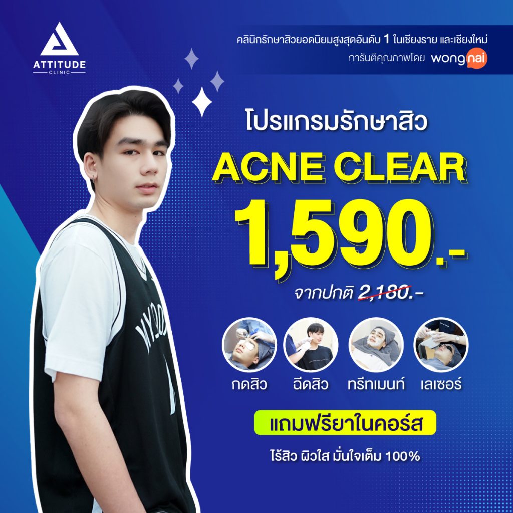 รักษาสิว Acne Clear รวมการรักษาสิวและรอยสิว คุ้มสุดๆ กดสิว ฉีดสิว พบคุณหมอ ทรีทเมนท์ มาร์สฆ่าเชื้อสิว และเลเซอร์ IPL ลดรอยสิว ในราคาเพียง 1,590 บาท จากราคาปกติ 2,180 บาท ฟรียาในคอร์ส