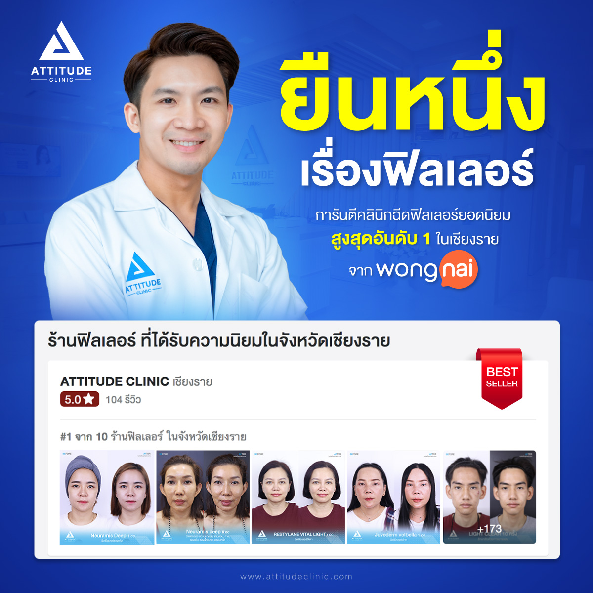 ฟิลเลอร์เติมเต็ม ปรับรูปหน้า ฉีดฟิลเลอร์เชียงราย ที่ Attitude Clinic โดยคุณหมอผู้เชี่ยวชาญการฉีดฟิลเลอร์โดยเฉพาะ สวยต้องปลอดภัย ใส่ใจทุกขั้นตอน ฉีดฟิลเลอร์กับหมอนุ ฉีดฟิลเลอร์ใต้ตา ฉีดฟิลเลอร์ที่ Attitude Clinic รีวิวเยอะที่สุด ฟิลเลอร์แท้ มั่นใจได้เลย