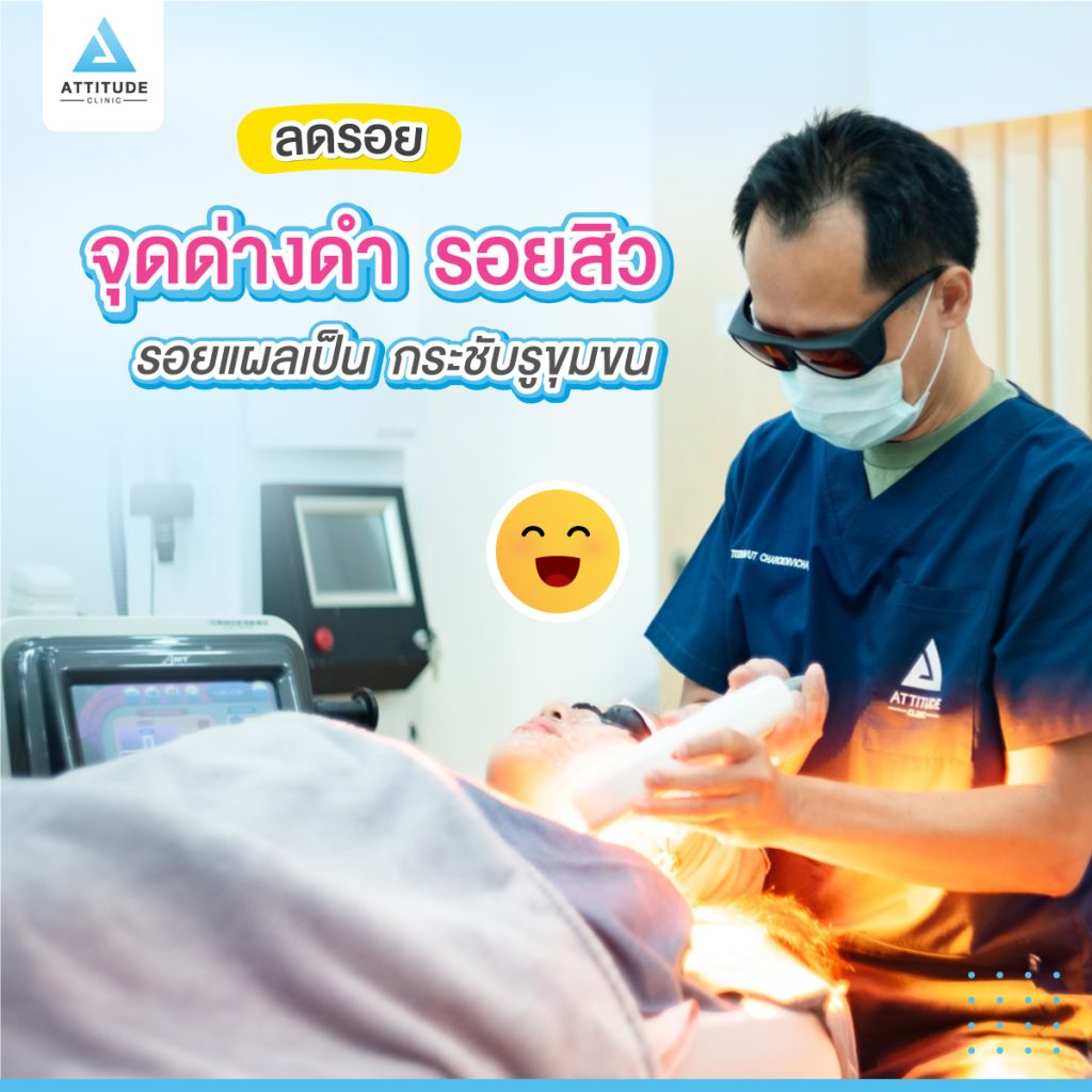 สุดยอดเลเซอร์ รักษารอยสิวเชียงใหม่ ที่ Attitude Clinic ด้วยเลเซอร์หน้าใส IPL ครอบคลุมทุกปัญหาผิว รอยแดง รอยดำจากสิวจางลง มั่นใจเกิน 100 หมออยู่ทุกวัน ดูแลเองทุกเคส รีวิวเพียบ