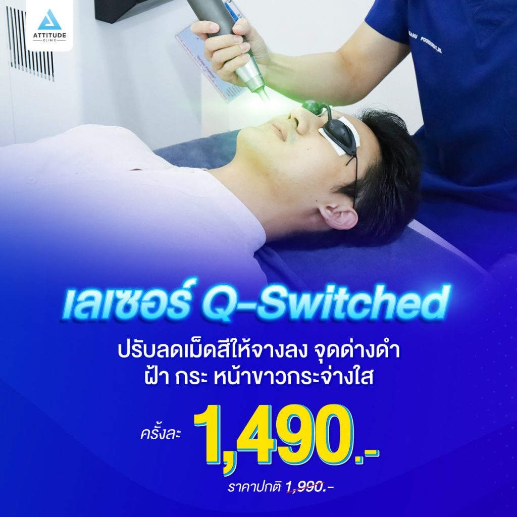 ฝ้าจางลง จนสามีและลูกยังทัก หลังทำเลเซอร์ Q-Switched รักษาฝ้า ไป 3 ครั้ง ที่ Attitude Clinic สาขาเชียงราย ลำปาง เชียงใหม่ หมออยู่ประจำทุกวัน ดูแลเองทุกเคส รีวิวเพียบ