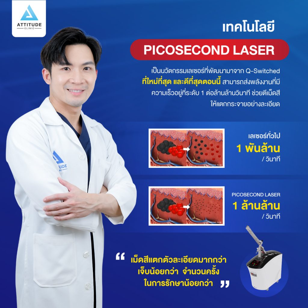 รักษาหลุมสิวด้วยเครื่อง Picocare 450 : Picosecond Laser เชียงราย