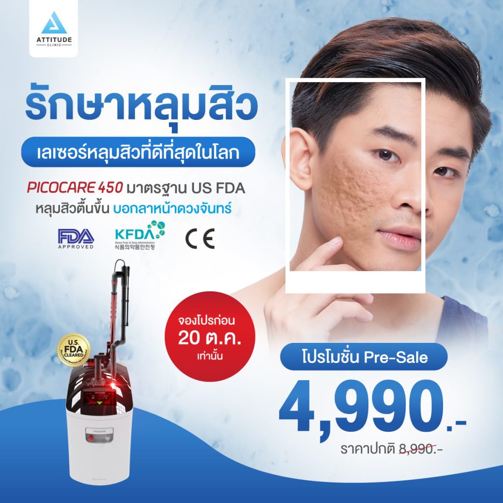 รักษาหลุมสิวด้วยเครื่อง Picocare 450 : Picosecond Laser เชียงราย