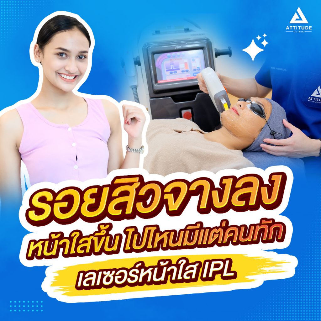 สุดยอดเลเซอร์ รักษารอยสิวลำปาง ที่ Attitude Clinic ด้วยเลเซอร์หน้าใส IPL ครอบคลุมทุกปัญหาผิว รอยแดง รอยดำจากสิวจางลง มั่นใจเกิน 100 หมออยู่ทุกวัน ดูแลเองทุกเคส รีวิวเพียบ