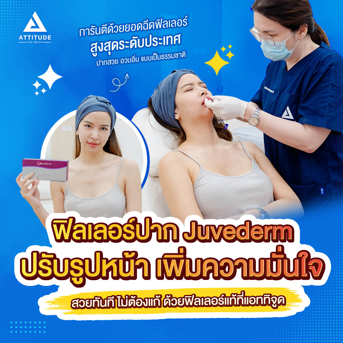 รีวิวฉีดฟิลเลอร์ปากอิ่ม สาย ฝ. Juvederm Volift