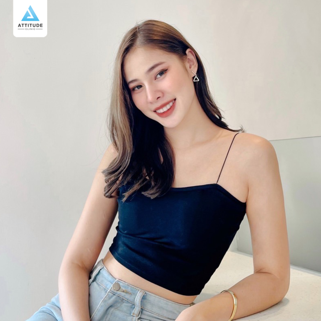 รีวิวเสริมหน้าผากผู้ชาย ด้วยซิลิโคน Fitme แบบแหล่อ เฉพาะบุคคล เติมเต็มหน้าผาก ปรับรูปหน้าอย่างเป็นธรรมชาติ โดยหมอยุ้ย Attitude Clinic รัชดา รีวิวเยอะที่สุด หมออยู่ประจำ ทำเองทุกเคส