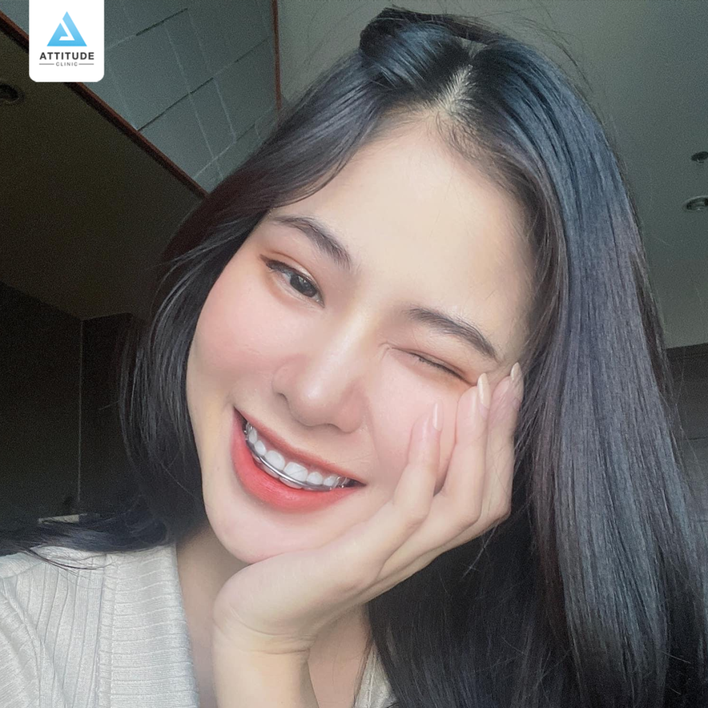 รีวิวทำตาสองชั้น แบบกรีดสั้น