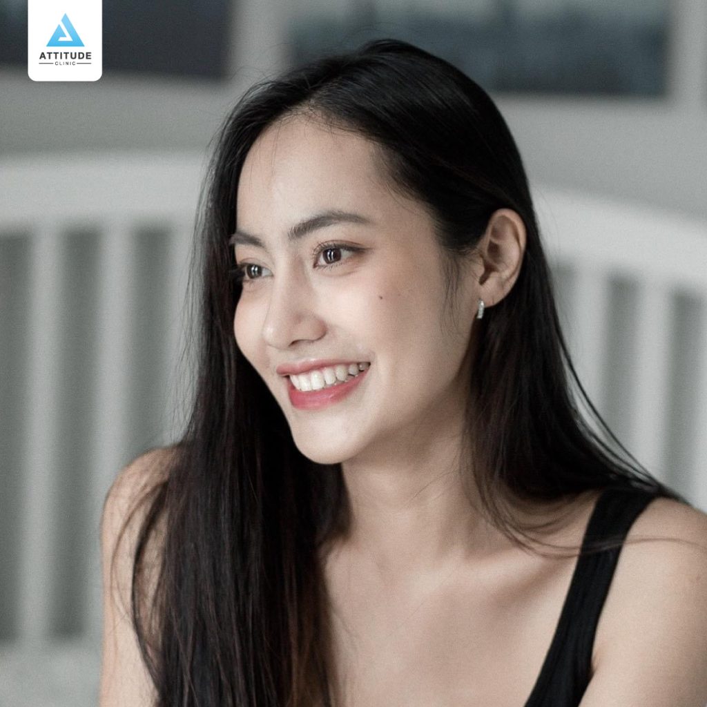 รีวิวเสริมจมูกแบบปรับฐานจมูก ทรงสวยเป็นธรรมชาติ รัดแกน ทรงจมูกเริ่มชัด ยิ่งสวยละมุน เทคนิค Semi Open เกาหลี โดยคุณหมอยุ้ย Attitude Clinic รัชดา ของคุณเจน Miss Grand Nonthaburi 2020 หมอยุ้ยเสริมจมูก เสริมจมูกที่ Attitude Clinic