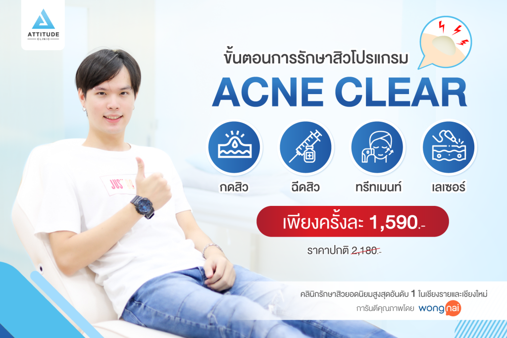 ขั้นตอนการรักษาสิวโปรแกรม Acne Clear กดสิว ฉีดสิว ทรีทเมนท์ เลเซอร์ ออกแบบมาเพื่อคนเป็นสิวและรอยสิวโดยเฉพาะ เห็นผลไว ใช้เวลาในการรักษาไม่นาน โดยแพทย์ผู้เชี่ยวชาญดูแลเองทุกเคส ตรงจุด หายจริง ไม่เลี้ยงไข้ การันตีสิวหายแล้วกว่า 5,000 คน Attitude Clinic เชียงใหม่ เชียงราย ลำปาง