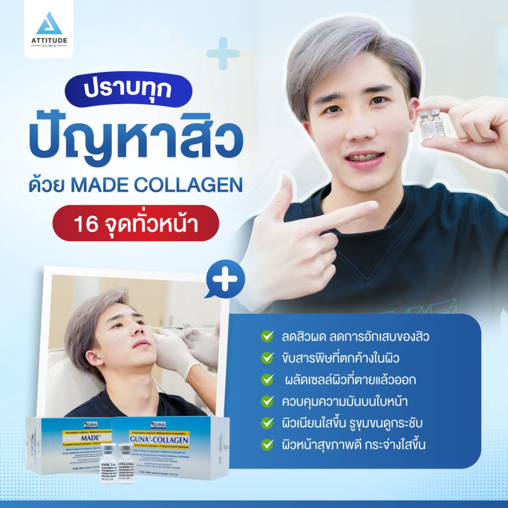 สิวอักเสบ สิวอุดตัน สิวฮอร์โมน สิววัยรุ่น!!! ปราบเรียบทุกปัญหาสิวด้วย Made Collagen 16 จุดที่ Attitude Clinic