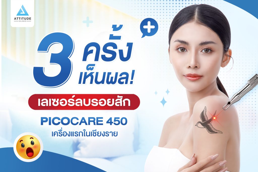 ลบรอยสัก 3 ครั้งเห็นผล! ด้วย PICOCARE 450 เครื่องแรกในเชียงราย