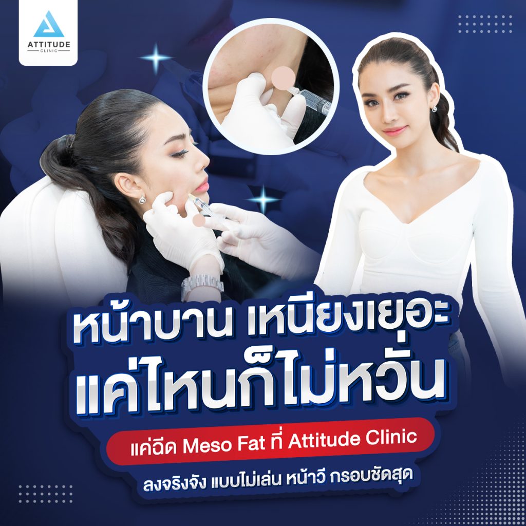 รีวิวฉีดเมโสแฟต สลายไขมัน แก้ม เหนียง