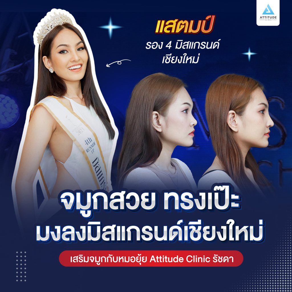 รีวิวเสริมจมูกสำหรับผู้หญิง ที่ Attitude Clinic สาขารัชดา