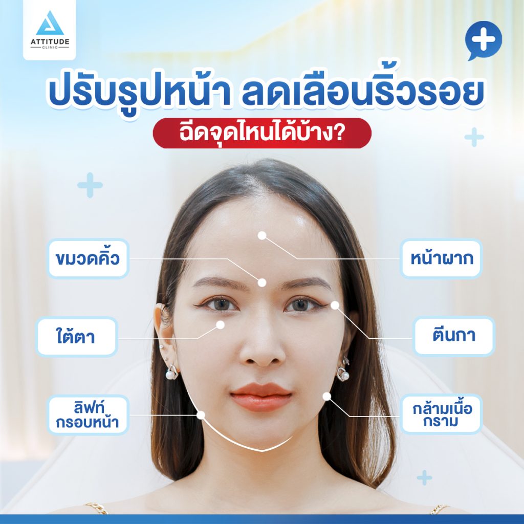 3 ข้อต้องรู้ก่อนมาโบท็อกซ์ที่ Attitude Clinic