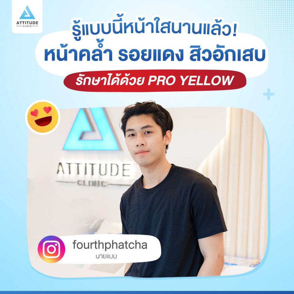 รู้อะไรไม่เท่ารู้งี้! ปัญหาหน้าหมองคล้ำ รอยแดงสิว สิวอักเสบ รักษาได้! ด้วยเลเซอร์ Pro Yellow ที่แอททิจูดคลินิก