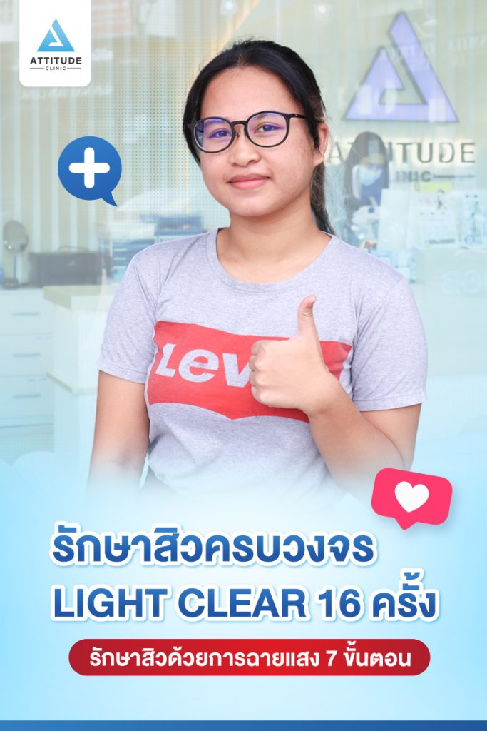 รีวิวรักษาสิวครบวงจร โปรแกรม Light Clear ด้วยการฉายแสง 7 ขั้นตอน จำนวน 16 ครั้ง ของน้องโบแดง ที่มีปัญหาสิวอุดตัน สิวอักเสบสิว สิวฮอร์โมน และรอยแดงจากสิว