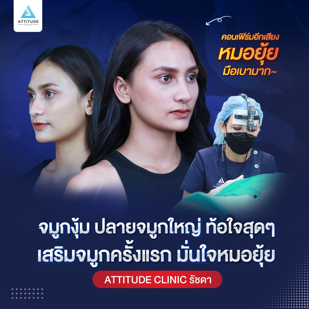 รีวิวเสริมจมูก