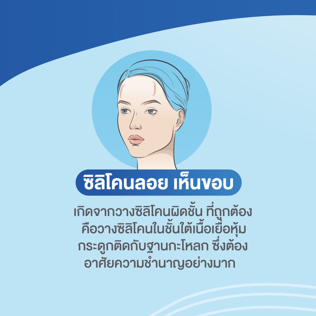 ปัญหาที่บ่อยในเคสแก้หน้าผาก หมอยุ้ย Attitude Clinic รัชดา
