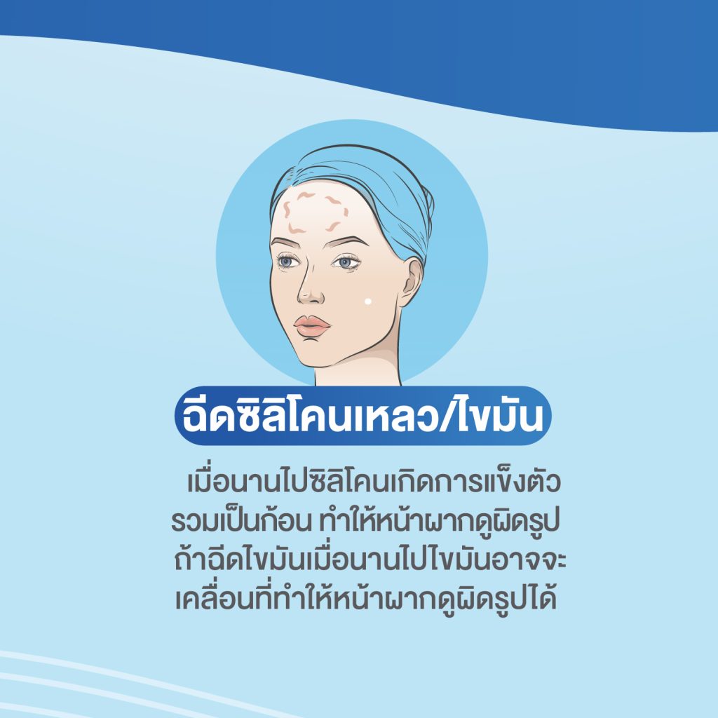ปัญหาที่บ่อยในเคสแก้หน้าผาก หมอยุ้ย Attitude Clinic รัชดา