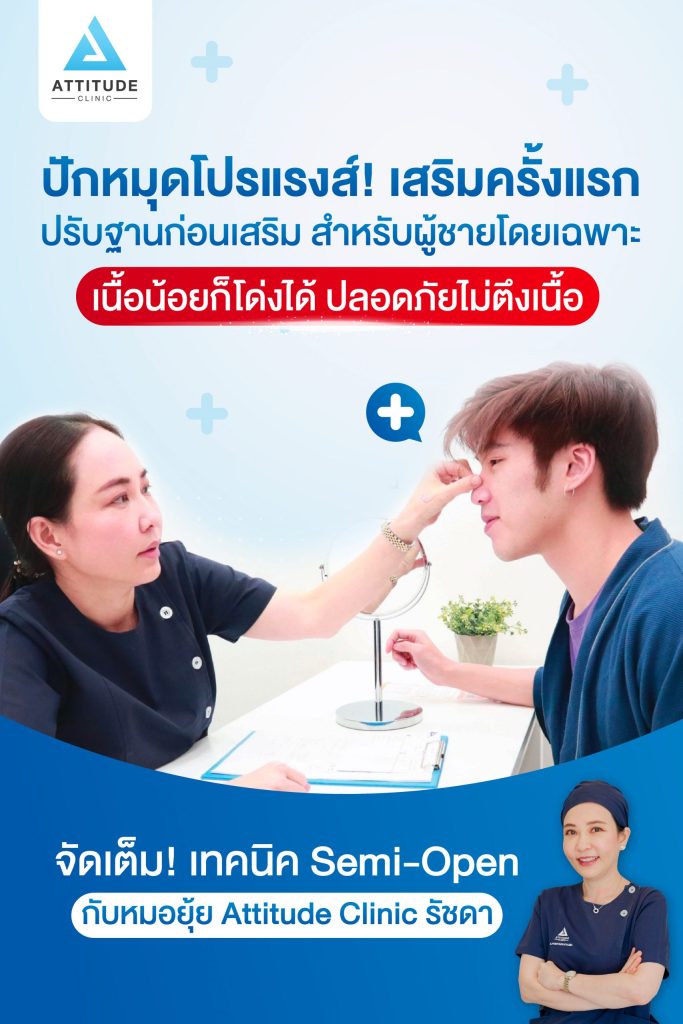 เสริมจมูกผู้ชายกับหมอยุ้ย Attitude Clinic รัชดาโปรโมชั่นราคาพิเศษสุดๆ