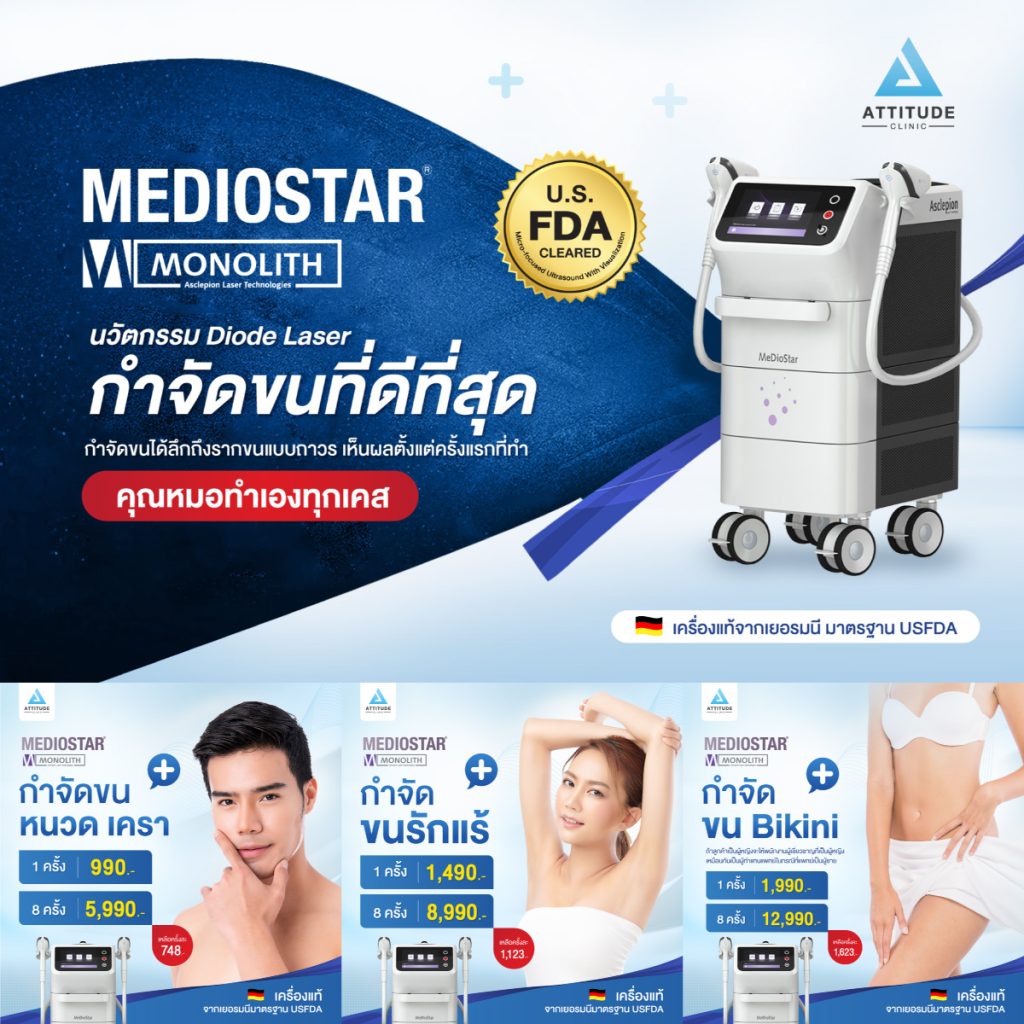 เลเซอร์กำจัดขนด้วยเครื่อง MEDIOSTAR®️ Monolith เชียงราย