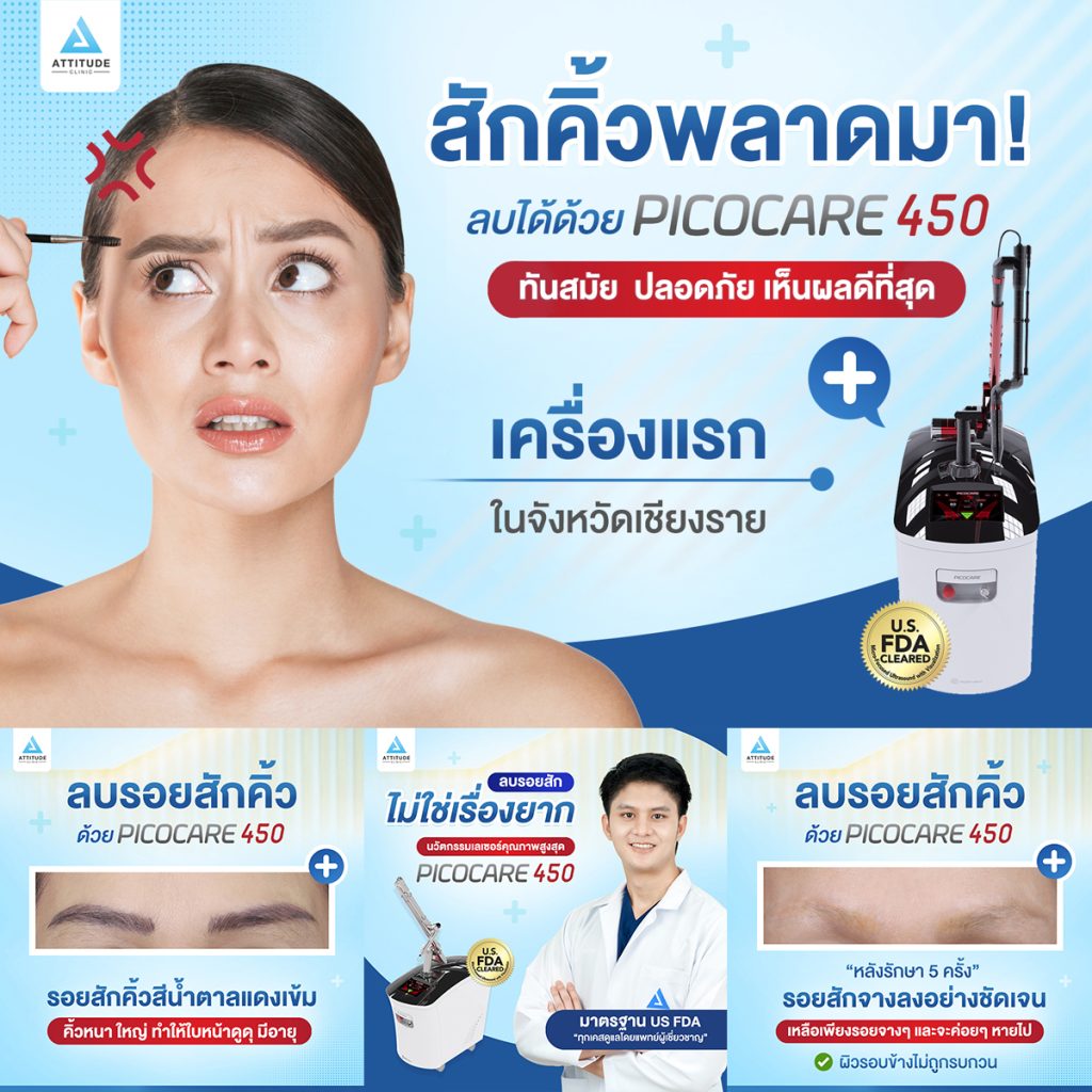 สักคิ้วพลาดมาก็ลบได้ ด้วย Picocare450 ที่แอททิจูด คลินิก