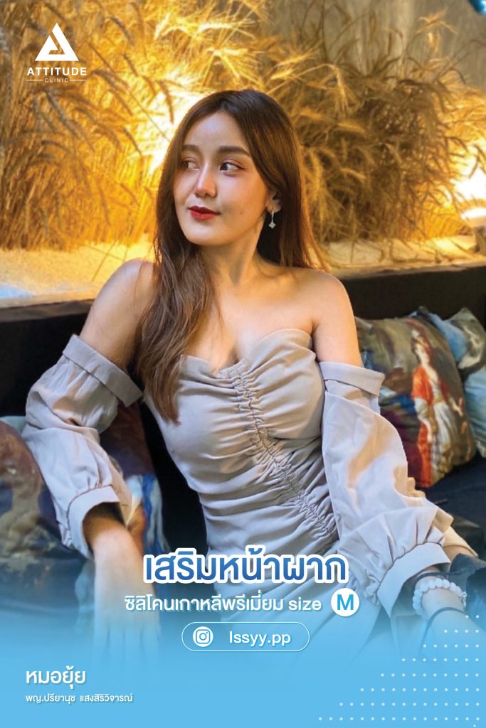 อัพเดทเสริมหน้าผาก ซิลิโคน เกาหลีพรีเมียม size M หน้าหวานทุกมุม ละมุนทุกองศา โดยคุณหมอยุ้ย