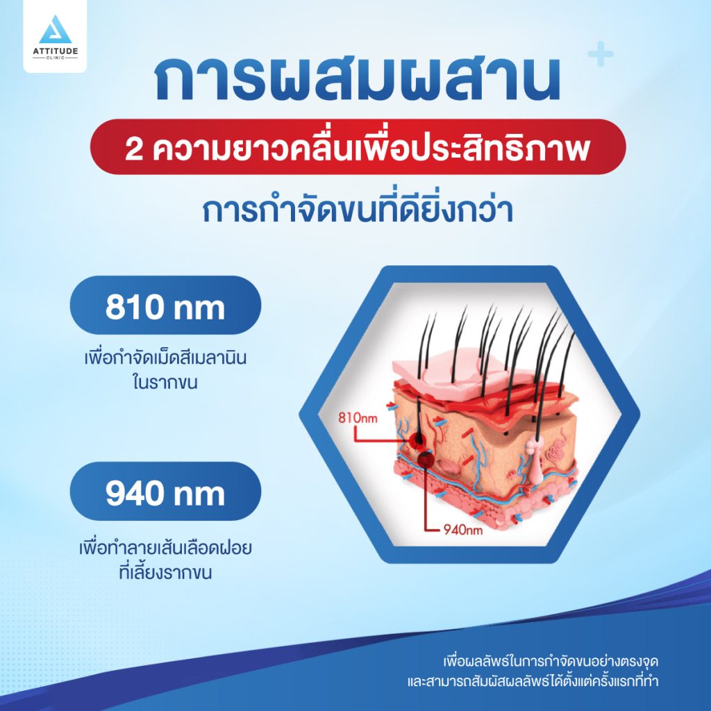 เครื่องกำจัดขนที่ดีที่สุด แอททิจูดคลินิก กล้าการันตี MeDioStar Monolith เทคโนโลยี Diode Laser สำหรับกำจัดขนโดยเฉพาะ ปลอดภัย! ไม่เจ็บ! ไม่เบิร์น!