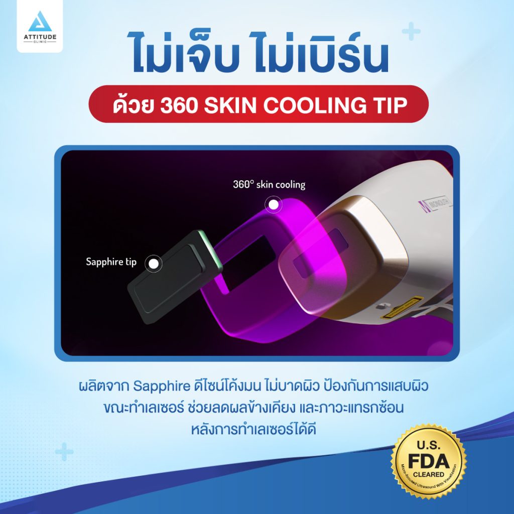 เครื่องกำจัดขนที่ดีที่สุด แอททิจูดคลินิก กล้าการันตี MeDioStar Monolith เทคโนโลยี Diode Laser สำหรับกำจัดขนโดยเฉพาะ ปลอดภัย! ไม่เจ็บ! ไม่เบิร์น!