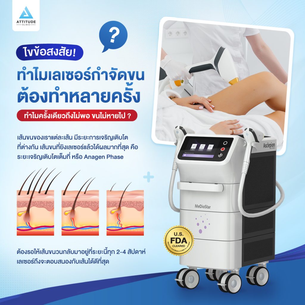 ทำไมเลเซอร์กำจัดขนต้องทำหลายครั้ง ไขข้อสงสัย ทำไมเลเซอร์กำจัดขนต้องทำหลายครั้ง?
