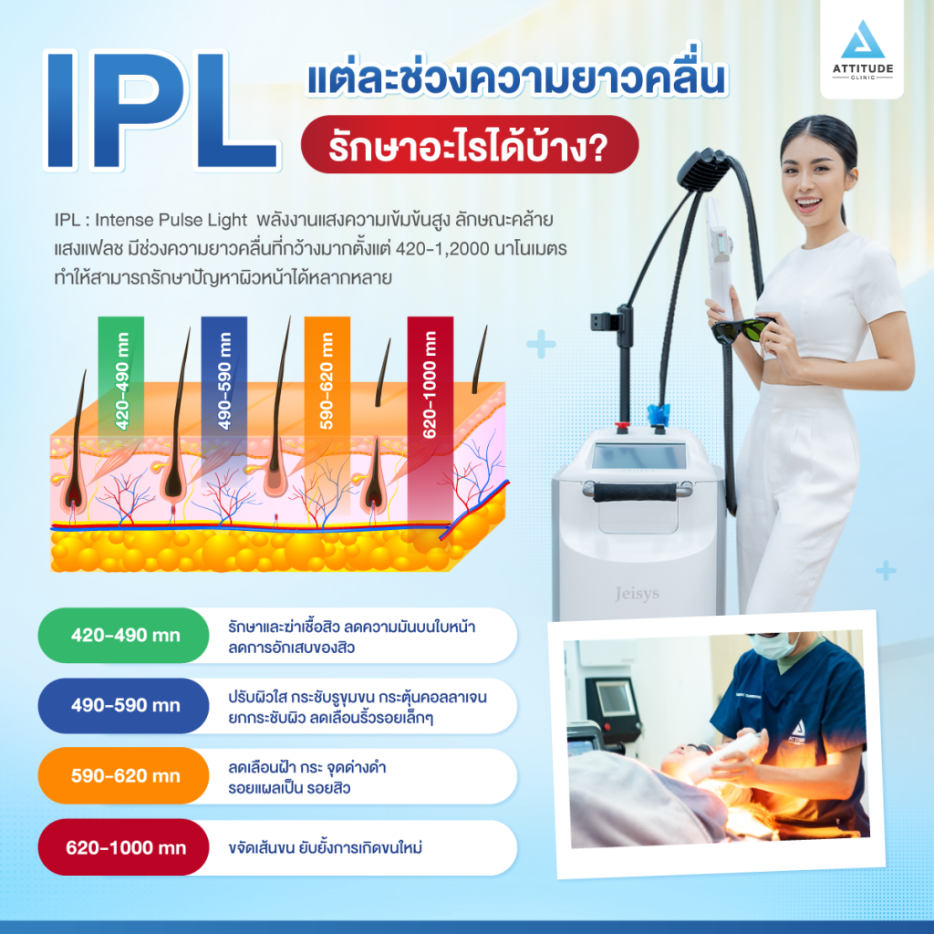 IPL คืออะไร IPL คืออะไร? แต่ละช่วงความยาวคลื่น รักษาอะไรได้บ้าง?