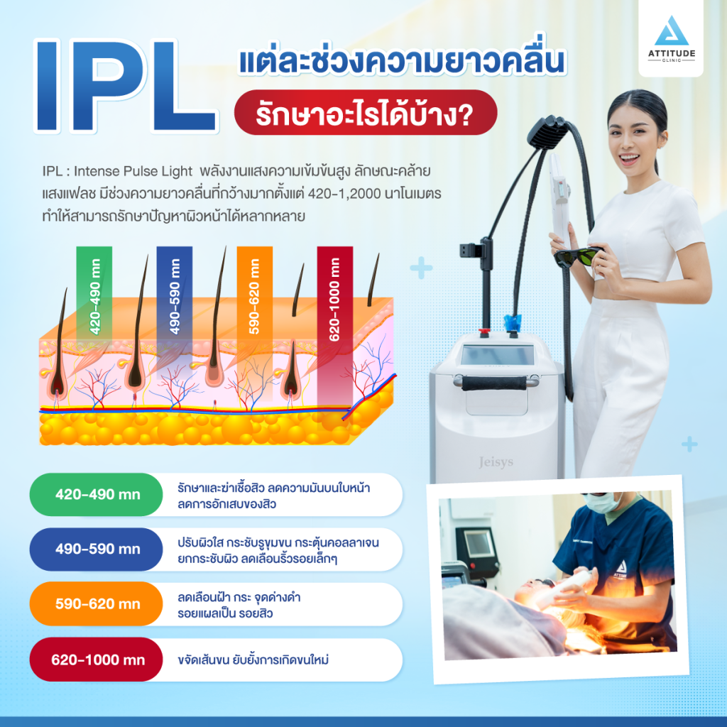 IPL คืออะไร? แต่ละช่วงความยาวคลื่น รักษาอะไรได้บ้าง?