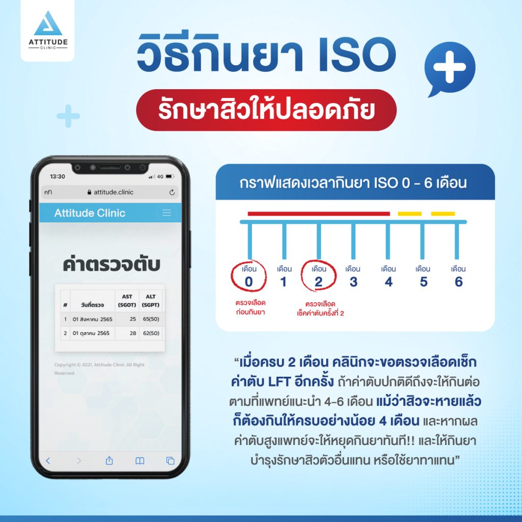 ยารักษาสิว iso ความเชื่อ VS ความจริง : เมื่อเริ่มกินยา iso รักษาสิว ไม่สามารถหยุดได้ต้องกินตลอดไป ?