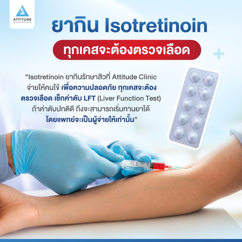 ยารักษาสิว iso ความเชื่อ VS ความจริง : เมื่อเริ่มกินยา iso รักษาสิว ไม่สามารถหยุดได้ต้องกินตลอดไป ?