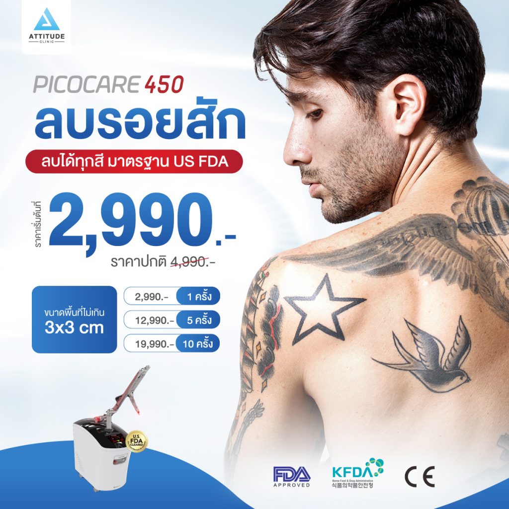 โปรโมชั่นลบรอยสักด้วยเครื่อง Picocare 450 (Picosecond Laser)