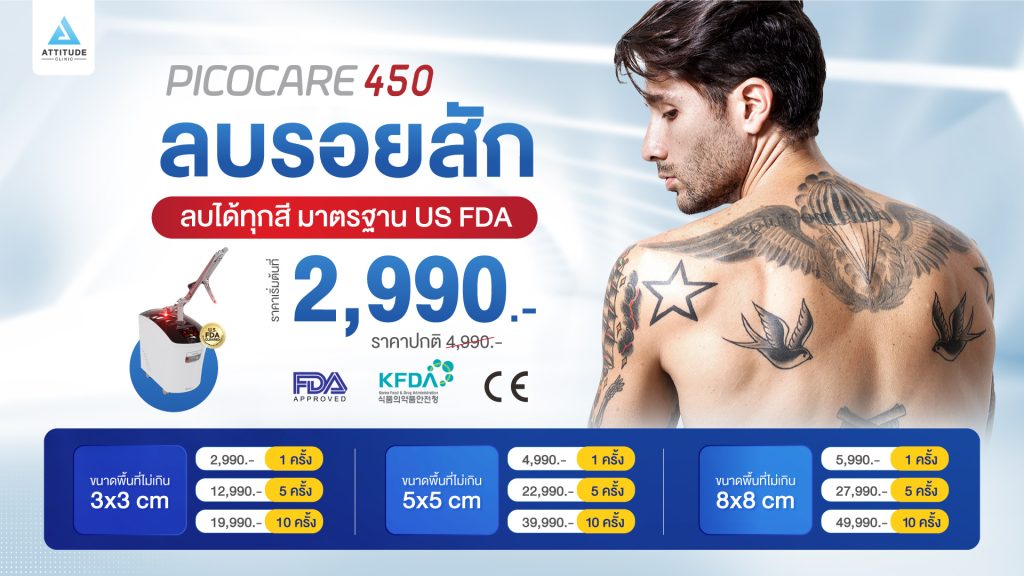 โปรโมชั่นลบรอยสักด้วยเครื่อง Picocare 450 (Picosecond Laser)