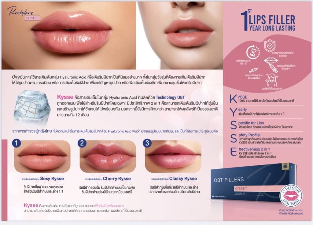 ฟิลเลอร์ปาก Restylane Kysse