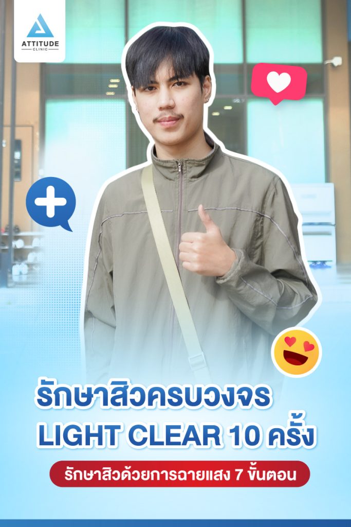 รีวิวรักษาสิวครบวงจร น้องเจม โปรแกรม Light Clear รักษาสิวด้วยการฉายแสง 7 ขั้นตอน จำนวน 10 ครั้ง 