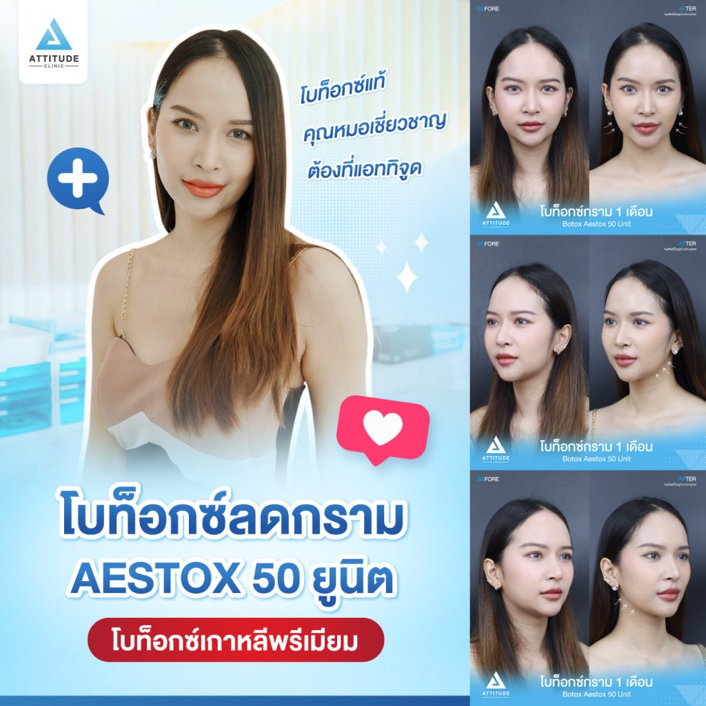 รีวิวฉีดโบท็อกซ์กราม Aestox จำนวน 50 ยูนิต ของน้องนกยูง อัพเดตหลังฉีด 1 เดือน โบท็อกซ์แท้ คุณภาพที่ Attitude Clinic