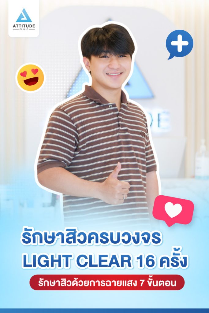 รีวิวรักษาสิวครบวงจร น้องเพชร โปรแกรม Light Clear 7 ขั้นตอน จำนวน 16 ครั้ง ที่มีปัญหาสิว รอยสิวจัดเต็ม หลังรักษาสิวตอนนี้หน้าใสวิ้ง ผิวเรียบเนียนมั่นใจสุดๆ 